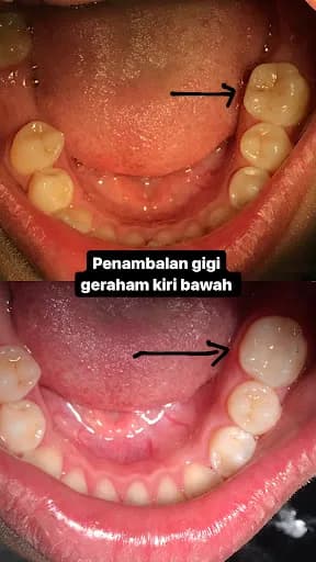 drg. Putu Fenti Surya Pratami - Dokter Gigi Bali - Main Image