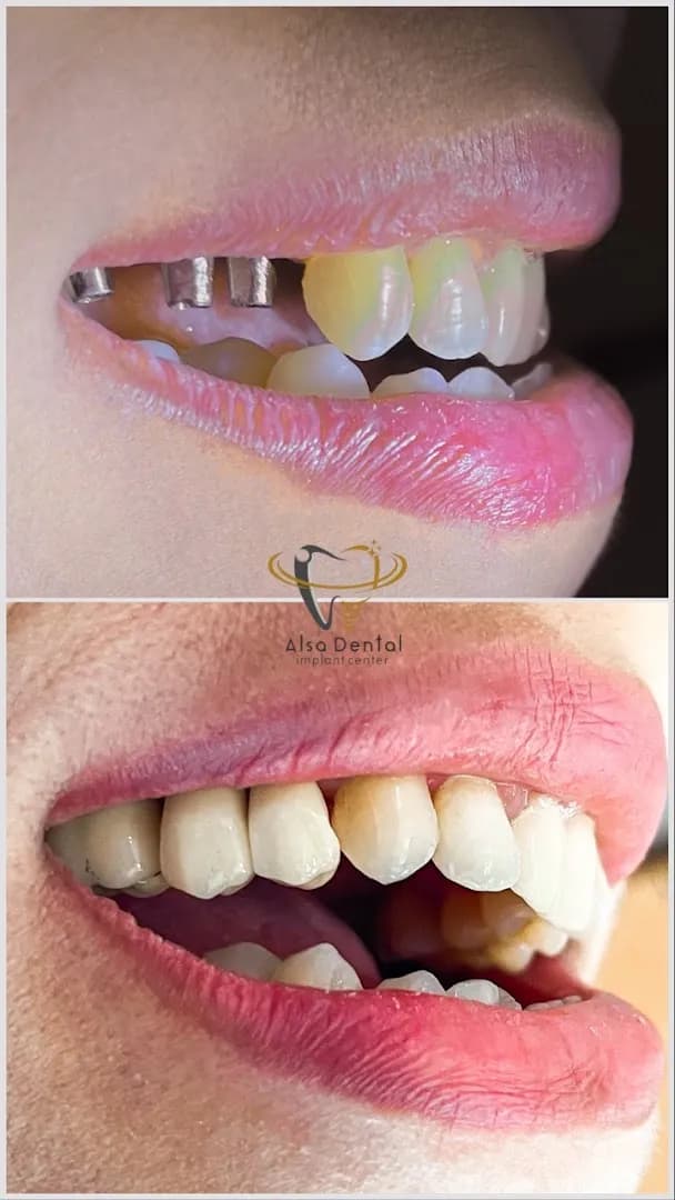 Klinik Gigi dan Bedah Mulut - Alsa Dental Bali - Main Image