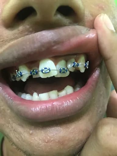 Praktek Dokter Gigi Drg. Luh Eka Budiayu Komalasari - Main Image