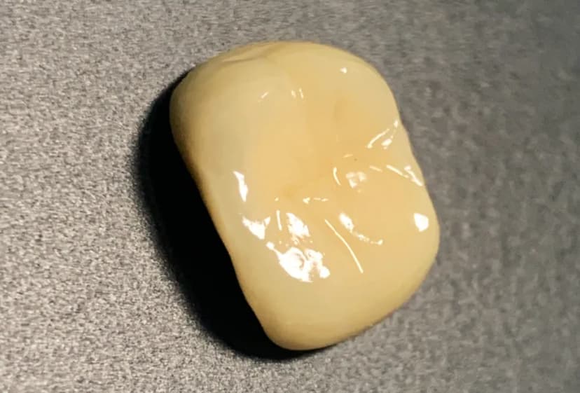 (SDC) Shine Dental Care Bali - Main Image