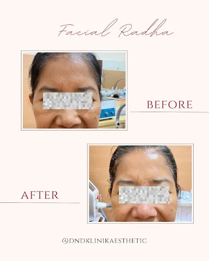 DND Klinik Pratama Aesthetic Clinic & Anti Aging 1