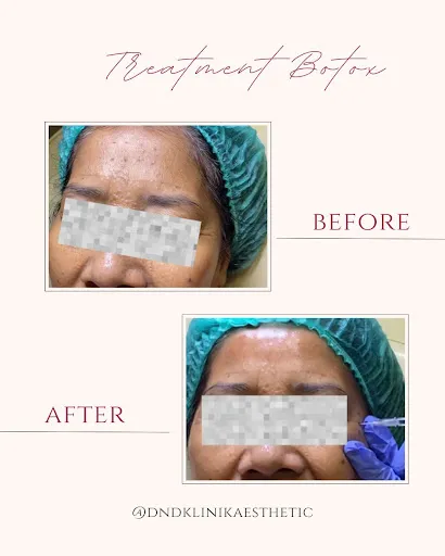 DND Klinik Pratama Aesthetic Clinic & Anti Aging 2