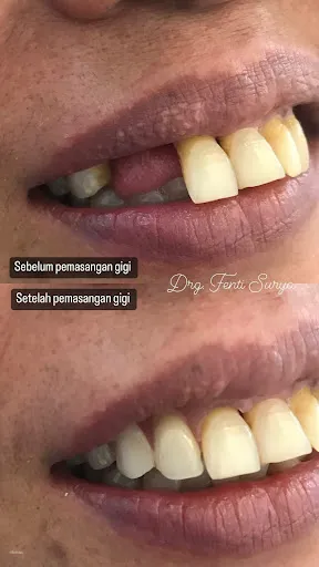 drg. Putu Fenti Surya Pratami - Dokter Gigi Bali 2