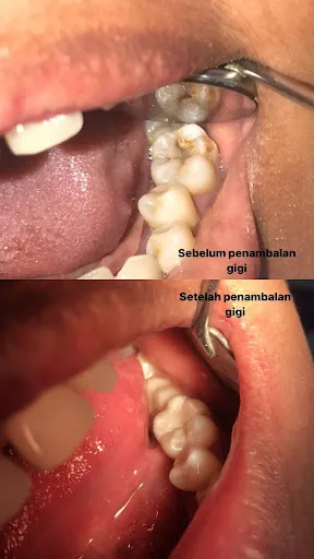 drg. Putu Fenti Surya Pratami - Dokter Gigi Bali 3