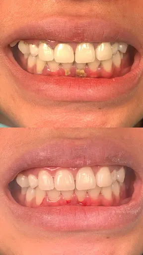 Ubud dentist - Carla Dental 1