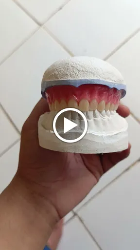 Tukang Gigi (Nusa Dua) 2