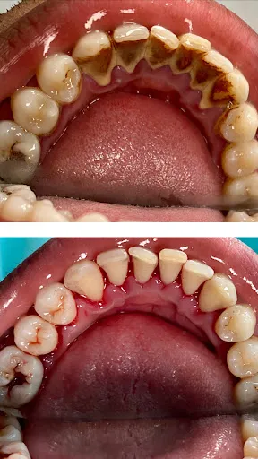 DentSmyle Dental 3