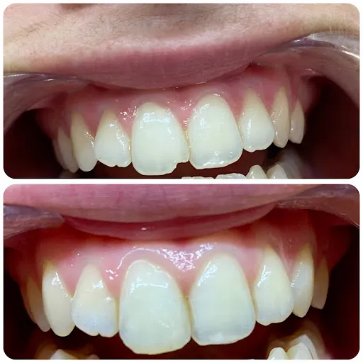 DentSmyle Dental 4