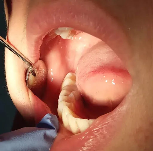 Dokter Gigi | Dentist Ubud Drg. Kadek Ayu Dewi Trisnayanti 2