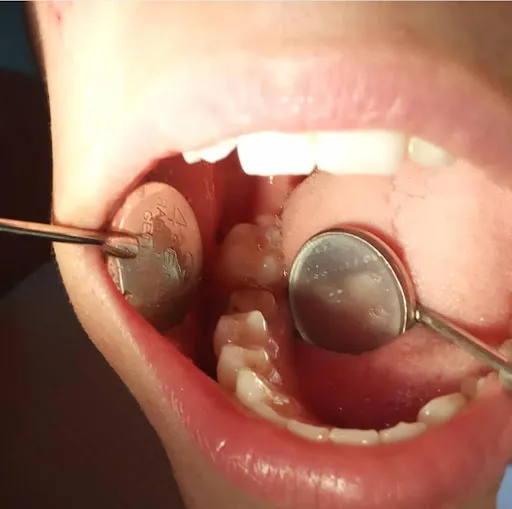 Dokter Gigi | Dentist Ubud Drg. Kadek Ayu Dewi Trisnayanti 3