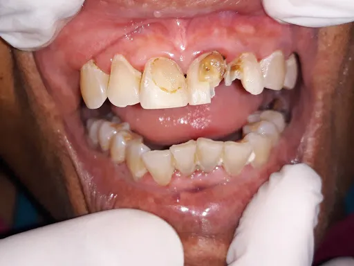 Vozz Dental | Dokter Gigi Gianyar 1