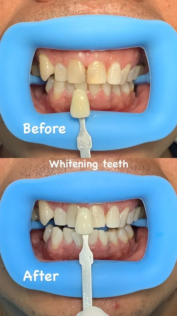 (SDC) Shine Dental Care Bali 3