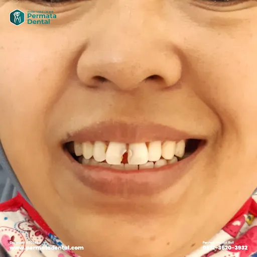 PERMATA DENTAL DOKTER GIGI Bali & ESTETIK 1