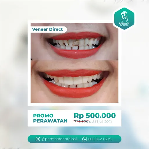 PERMATA DENTAL DOKTER GIGI Bali & ESTETIK 4
