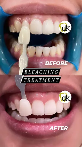 Your Dental Care 1