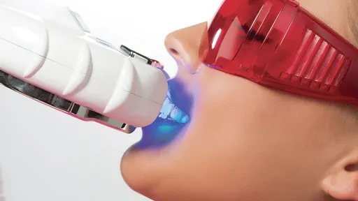 Bali Smile Teeth Whitening Seminyak 2