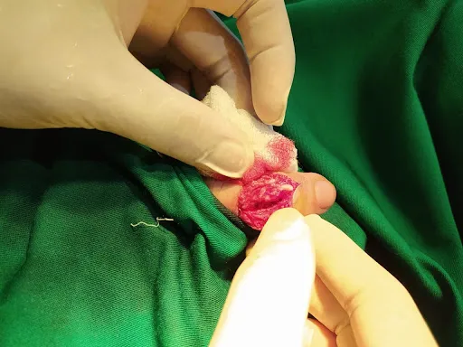 Orthopedic & Brace Center Bali (dr Astayogi) 4