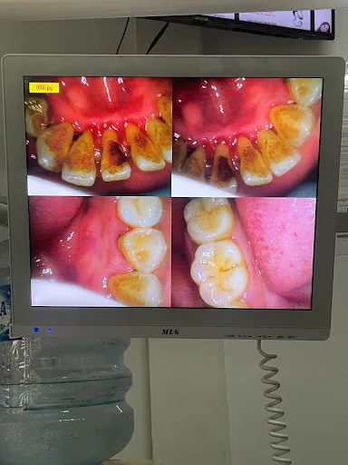 SG Dental Solution Bali 2
