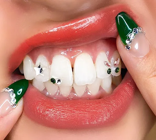 Gemuine Tooth Gems 2