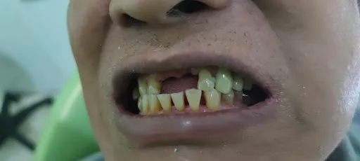 Drg. I Gede Andy Kumbara Putra (Dokter Gigi Denpasar/Dentist) 4