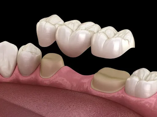 Praktek Dokter Gigi | Dentist Drg. Kadek Ayu Dewi Trisnayanti