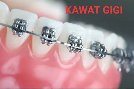 Praktek Dokter Gigi | Dentist Drg. Kadek Ayu Dewi Trisnayanti 3